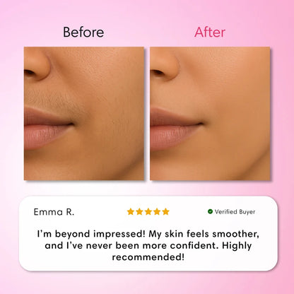 Hair Removal Trilogy Kit