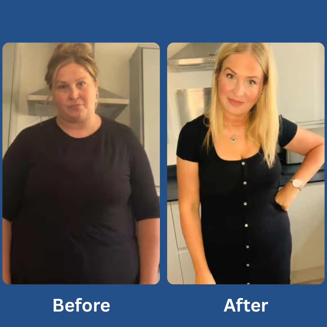 GLP-Activate: Silence Food Noise. Lose Weight Naturally.